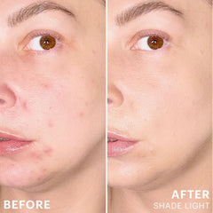 Spot Treat Concealer