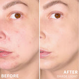 Spot Treat Concealer